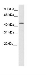 HMG20B / BRAF35 Antibody - Bladder Lysate.  This image was taken for the unconjugated form of this product. Other forms have not been tested.