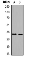 HMG20B / BRAF35 Antibody - Western blot analysis of BRAF35 expression in HeLa (A); HEK293T (B) whole cell lysates.