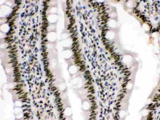 HMGB3 Antibody - anti-HMG4 Picoband antibody IHC(P): Rat Intestine Tissue