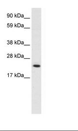 HMGB3 Antibody - Placenta Lysate.  This image was taken for the unconjugated form of this product. Other forms have not been tested.