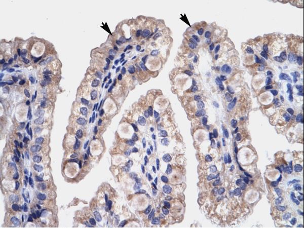 HMGB3 Antibody - HMGB3 antibody ARP35766_T100-NP_005333-HMGB3 (high-mobility group box 3) Antibody was used in IHC to stain formalin-fixed, paraffin-embedded human intestine.  This image was taken for the unconjugated form of this product. Other forms have not been tested.