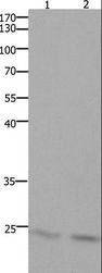 HMGB3 Antibody - Western blot analysis of Mouse lung and brain tissue, using HMGB3 Polyclonal Antibody at dilution of 1:700.