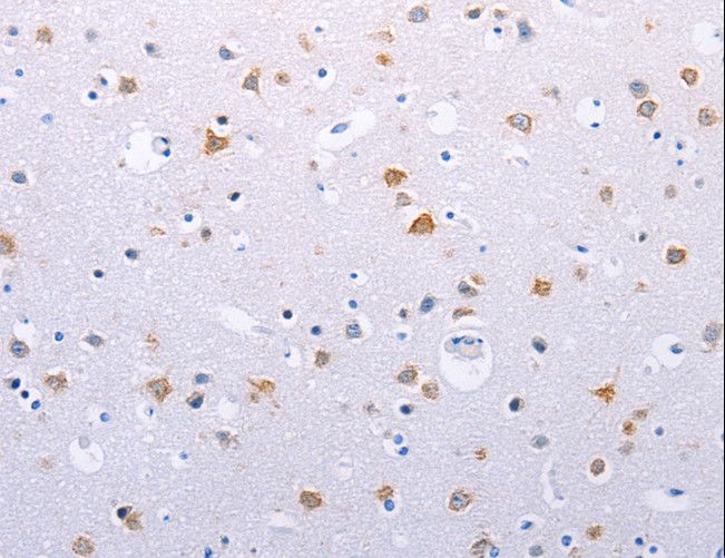 HMGB3 Antibody - Immunohistochemistry of paraffin-embedded Human brain using HMGB3 Polyclonal Antibody at dilution of 1:30.