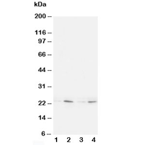 HMGB4 Antibody - Western blot testing of HMGB4 antibody and Lane 1: rat brain; 2: rat testis; 3: (h) Jurkat; 4: (h) HT1080 cell lysate