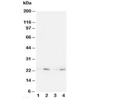 HMGB4 Antibody - Western blot testing of HMGB4 antibody and Lane 1: rat brain; 2: rat testis; 3: (h) Jurkat; 4: (h) HT1080 cell lysate