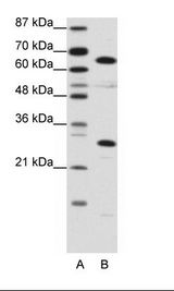 HMGB4 Antibody - A: Marker, B: Jurkat Cell Lysate.  This image was taken for the unconjugated form of this product. Other forms have not been tested.