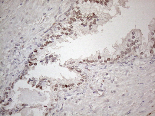 HMGB4 Antibody - Immunohistochemical staining of paraffin-embedded Human prostate tissue within the normal limits using anti-HMGB4 mouse monoclonal antibody. (Heat-induced epitope retrieval by 1mM EDTA in 10mM Tris buffer. (pH8.5) at 120°C for 3 min. (1:150)