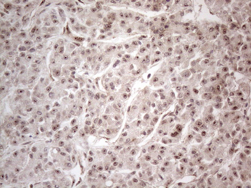 HMGB4 Antibody - Immunohistochemical staining of paraffin-embedded Human liver tissue within the normal limits using anti-HMGB4 mouse monoclonal antibody. (Heat-induced epitope retrieval by 1mM EDTA in 10mM Tris buffer. (pH8.5) at 120°C for 3 min. (1:150)