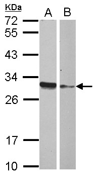 HMGB4 Antibody - Sample (30 ug of whole cell lysate) A: IMR32 B: MCF-7 12% SDS PAGE HMGB4 antibody diluted at 1:1000