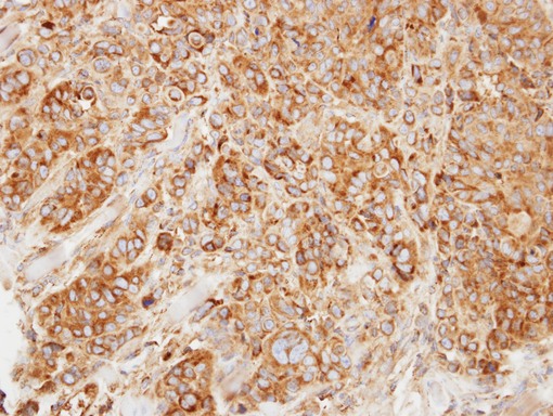 HMGCL Antibody - IHC of paraffin-embedded SW480 xenograft using HMGCL antibody at 1:500 dilution.