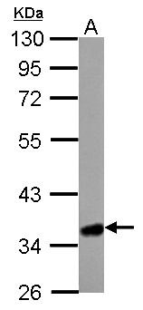 HMGCL Antibody - HMGCL antibody detects HMGCL protein by Western blot analysis. A. 50 ug mouse liver lysate/extract. 10 % SDS-PAGE. HMGCL antibody dilution:1:10000