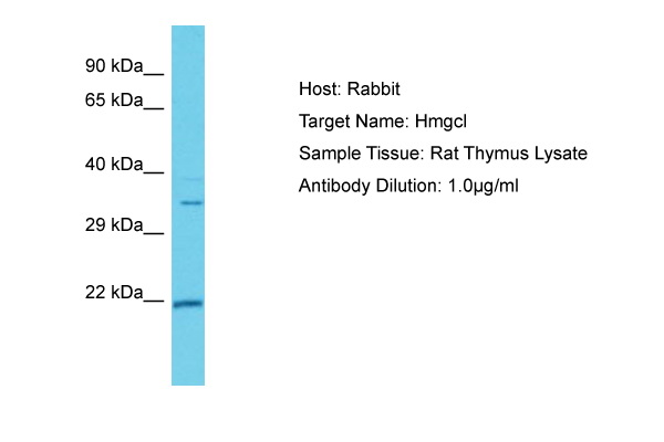 HMGCL Antibody -  This image was taken for the unconjugated form of this product. Other forms have not been tested.