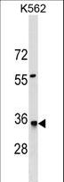 HMGCL Antibody - HMGCL Antibody western blot of K562 cell line lysates (35 ug/lane). The HMGCL antibody detected the HMGCL protein (arrow).