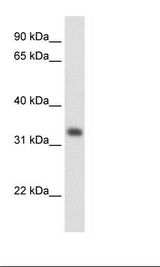 HMGCL Antibody - Fetal Liver Lysate.  This image was taken for the unconjugated form of this product. Other forms have not been tested.