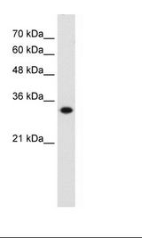 HMGCL Antibody - HepG2 Cell Lysate.  This image was taken for the unconjugated form of this product. Other forms have not been tested.