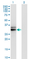 HMGCL Antibody - Western Blot analysis of HMGCL expression in transfected 293T cell line by HMGCL monoclonal antibody (M01), clone 4F4-D1.Lane 1: HMGCL transfected lysate(34.4 KDa).Lane 2: Non-transfected lysate.