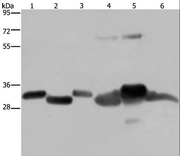HMGCL Antibody - Western blot analysis of Mouse thymus and human ovarian cancer tissue, mouse heart, human fetal liver, mouse liver tissue and SKOV3 cell, using HMGCL Polyclonal Antibody at dilution of 1:300.