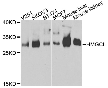 HMGCL Antibody - Western blot analysis of extracts of various cells.