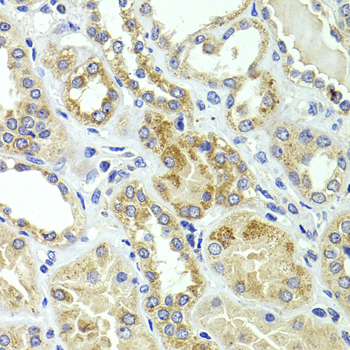 HMGCL Antibody - Immunohistochemistry of paraffin-embedded human kidney tissue.
