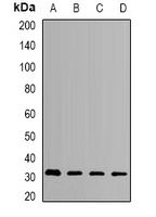 HMGCL Antibody - Western blot analysis of HMGCL expression in SKOV3 (A); MCF7 (B); mouse liver (C); mouse kidney (D) whole cell lysates.