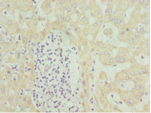 HMGCL Antibody - Immunohistochemistry of paraffin-embedded human liver tissue at dilution 1:100