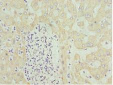 HMGCL Antibody - Immunohistochemistry of paraffin-embedded human liver tissue at dilution 1:100