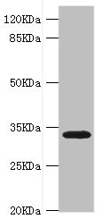 HMGCL Antibody - Western blot All Lanes:HMGCL antibody at 0.8ug/ml+rat liver tissue Secondary Goat polyclonal to rabbit at 1/10000 dilution Predicted band size: 35,27,21 kDa Observed band size: 34 kDa