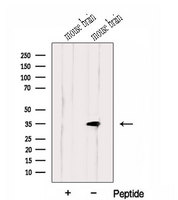 HMGCL Antibody - Western blot analysis of extracts of mouse brain tissue using HMGCL antibody. The lane on the left was treated with blocking peptide.