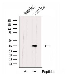 HMGCL Antibody - Western blot analysis of extracts of mouse brain tissue using HMGCL antibody. The lane on the left was treated with blocking peptide.