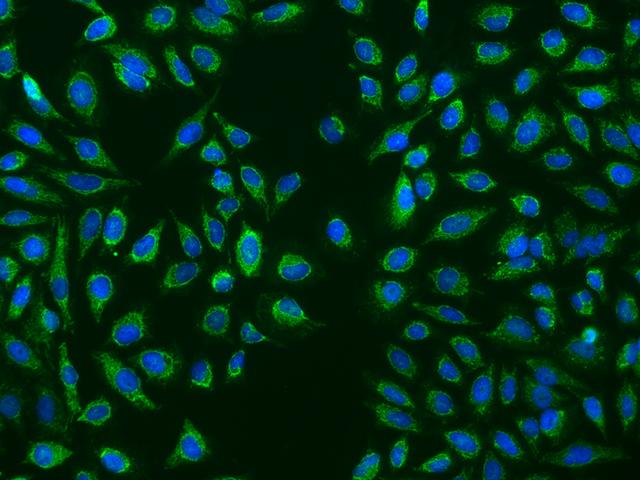 HMGCL Antibody - Immunofluorescence staining of HMGCL in HeLa cells. Cells were fixed with 4% PFA, permeabilzed with 0.1% Triton X-100 in PBS, blocked with 10% serum, and incubated with rabbit anti-Human HMGCL polyclonal antibody (dilution ratio 1:200) at 4°C overnight. Then cells were stained with the Alexa Fluor 488-conjugated Goat Anti-rabbit IgG secondary antibody (green) and counterstained with DAPI (blue). Positive staining was localized to Cytoplasm.