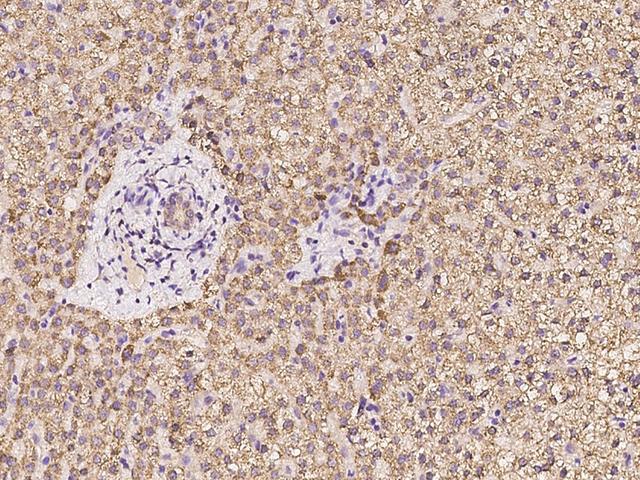 HMGCL Antibody - Immunochemical staining of human HMGCL in human liver with rabbit polyclonal antibody at 1:100 dilution, formalin-fixed paraffin embedded sections.