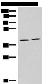 HMGCLL1 Antibody - Western blot analysis of Human placenta tissue and Human fetal brain tissue lysates  using HMGCLL1 Polyclonal Antibody at dilution of 1:1000
