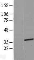 HMGCLL1 Protein - Western validation with an anti-DDK antibody * L: Control HEK293 lysate R: Over-expression lysate