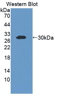 HMGCS1 / HMG-CoA Synthase 1 Antibody - Western blot of HMGCS1 / HMG-CoA Synthase 1 antibody.