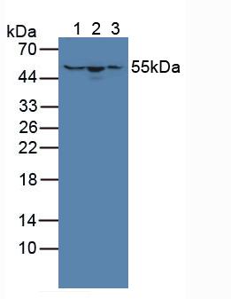 HMGCS1 / HMG-CoA Synthase 1 Antibody - Western Blot; Sample: Lane1: Human Hela Cells; Lane2: Human HepG2 Cells; Lane3: Human A431 Cells.