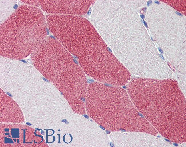 HMGCS1 / HMG-CoA Synthase 1 Antibody - Skeletal muscle, Human: Formalin-Fixed, Paraffin-Embedded (FFPE).  This image was taken for the unconjugated form of this product. Other forms have not been tested.