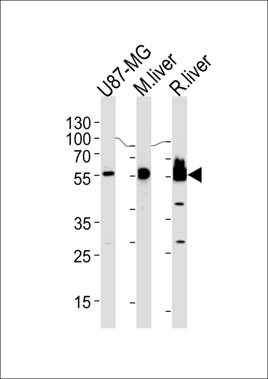 HMGCS1 / HMG-CoA Synthase 1 Antibody - HMGCS1 Antibody western blot of U87-MG cell line,mouse liver and rat liver lysates (35 ug/lane). The HMGCS1 antibody detected the HMGCS1 protein (arrow).