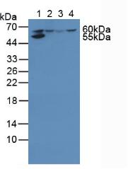 HMGCS1 / HMG-CoA Synthase 1 Antibody - Western Blot; Sample: Lane1: Human Liver Tissue; Lane2: Human 293T Cells; Lane3: Human HepG2 Cells; Lane4: Human Jurkat Cells.