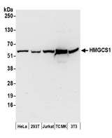 HMGCS1 / HMG-CoA Synthase 1 Antibody - Detection of human and mouse HMGCS1 by western blot. Samples: Whole cell lysate (50 µg) from HeLa, HEK293T, Jurkat, mouse TCMK-1, and mouse NIH 3T3 cells prepared using NETN lysis buffer. Antibodies: Affinity purified rabbit anti-HMGCS1 antibody used for WB at 0.1 µg/ml. Detection: Chemiluminescence with an exposure time of 30 seconds.
