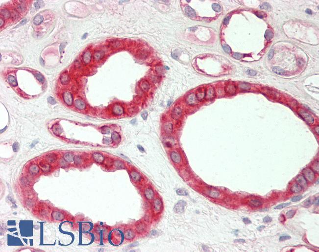 HMGCS1 / HMG-CoA Synthase 1 Antibody - Human Kidney: Formalin-Fixed, Paraffin-Embedded (FFPE).  This image was taken for the unconjugated form of this product. Other forms have not been tested.