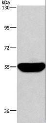 HMGCS1 / HMG-CoA Synthase 1 Antibody - Western blot analysis of Human fetal liver tissue, using HMGCS1 Polyclonal Antibody at dilution of 1:300.