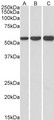 HMGCS1 / HMG-CoA Synthase 1 Antibody - Goat Anti-HMGCS1 (aa321-332) Antibody (1µg/ml) staining of HeLa (A), HepG2 (B) and K562 (C) lysates (35µg protein in RIPA buffer). Primary incubation was 1 hour. Detected by chemiluminescencence.