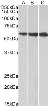 HMGCS1 / HMG-CoA Synthase 1 Antibody - Goat Anti-HMGCS1 Antibody (1µg/ml) staining of HeLa (A), HepG2 (B) and K562 (C) lysates (35µg protein in RIPA buffer). Primary incubation was 1 hour. Detected by chemiluminescencence.