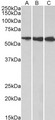 HMGCS1 / HMG-CoA Synthase 1 Antibody - Goat Anti-HMGCS1 Antibody (1µg/ml) staining of HeLa (A), HepG2 (B) and K562 (C) lysates (35µg protein in RIPA buffer). Primary incubation was 1 hour. Detected by chemiluminescencence.