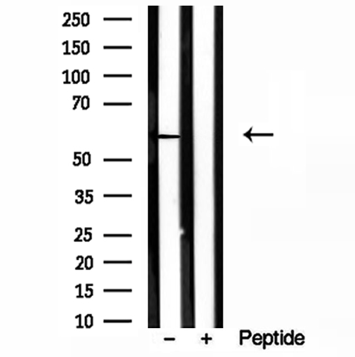 HMGCS1 / HMG-CoA Synthase 1 Antibody - Western blot analysis of extracts of A431 cells using HMGCS1 antibody.