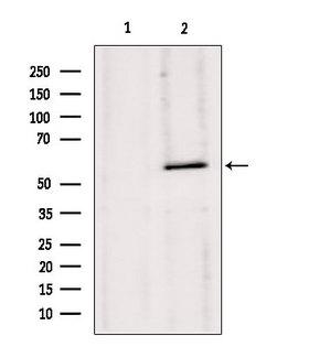 HMGCS1 / HMG-CoA Synthase 1 Antibody - Western blot analysis of extracts of 293 cells using HMGCS1 antibody. Lane 1 was treated with the blocking peptide.