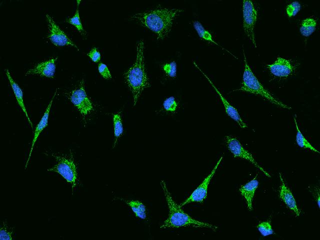 HMGCS1 / HMG-CoA Synthase 1 Antibody - Immunofluorescence staining of HMGCS1 in hela cells. Cells were fixed with 4% PFA, permeabilzed with 0.1% Triton X-100 in PBS, blocked with 10% serum, and incubated with rabbit anti-Human HMGCS1 polyclonal antibody (dilution ratio 1:200) at 4°C overnight. Then cells were stained with the Alexa Fluor 488-conjugated Goat Anti-rabbit IgG secondary antibody (green) and counterstained with DAPI (blue). Positive staining was localized to Cytoplasm.