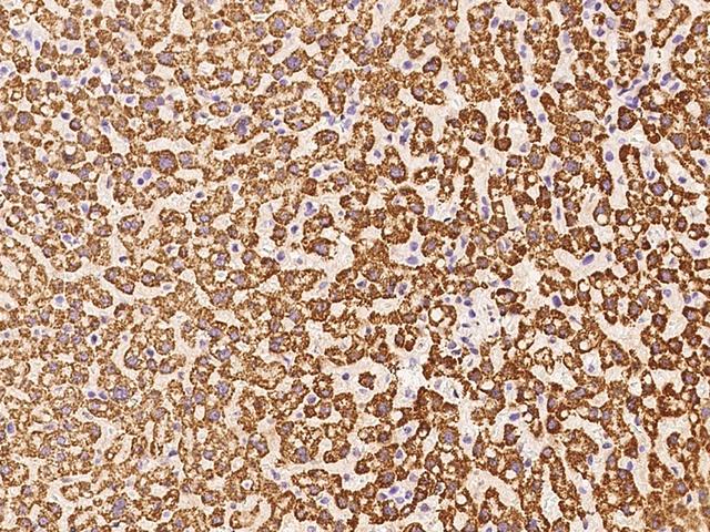 HMGCS1 / HMG-CoA Synthase 1 Antibody - Immunochemical staining of human HMGCS1 in human liver with rabbit polyclonal antibody at 1:100 dilution, formalin-fixed paraffin embedded sections.