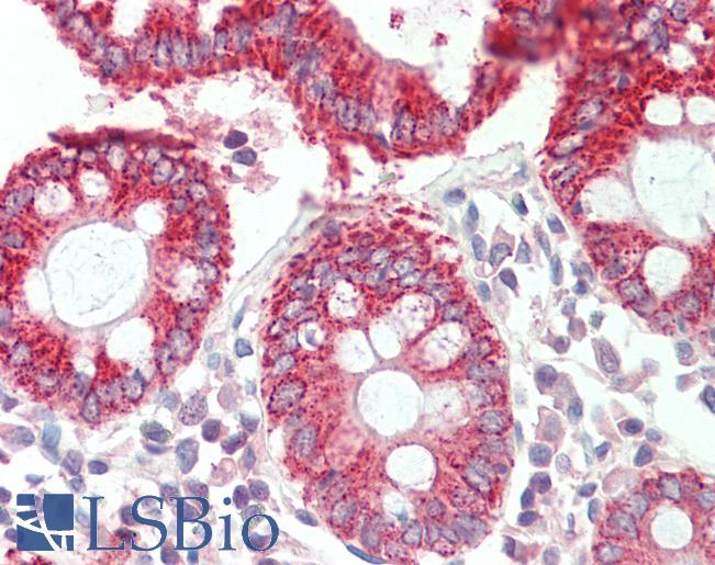 HMGCS2 / HMG-CoA Synthase 2 Antibody - Anti-HMGCS2 antibody IHC staining of human colon. Immunohistochemistry of formalin-fixed, paraffin-embedded tissue after heat-induced antigen retrieval. Antibody concentration 10 ug/ml.  This image was taken for the unconjugated form of this product. Other forms have not been tested.