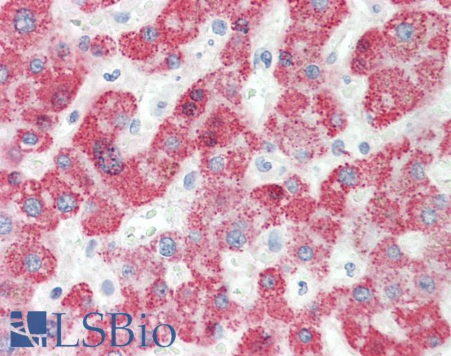 HMGCS2 / HMG-CoA Synthase 2 Antibody - Anti-HMGCS2 antibody IHC staining of human liver. Immunohistochemistry of formalin-fixed, paraffin-embedded tissue after heat-induced antigen retrieval.  This image was taken for the unconjugated form of this product. Other forms have not been tested.